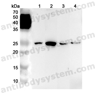 Anti-Human LYPLA1 Polyclonal Antibody