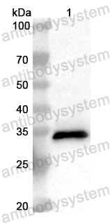 Anti-Human CTAG2 Polyclonal Antibody