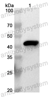 Anti-Human PPM1B Polyclonal Antibody