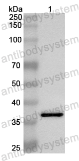 Anti-Human RP2 Polyclonal Antibody