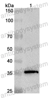 Anti-Human WDHD1 Polyclonal Antibody