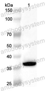 Anti-Human SLC25A12 Polyclonal Antibody