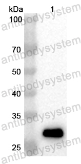 Anti-Human RAD51D Polyclonal Antibody