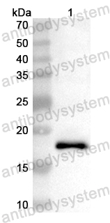 Anti-Human GRAP2 Polyclonal Antibody