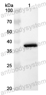 Anti-Human EIF3G Polyclonal Antibody
