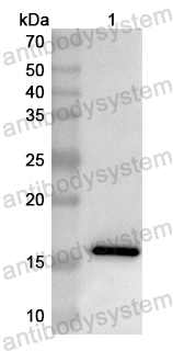 Anti-Human EIF3J Polyclonal Antibody