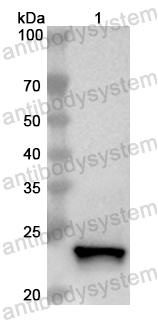 Anti-Human CIB2 Polyclonal Antibody