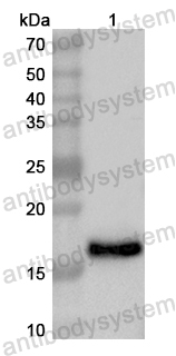 Anti-Human UPK1B Polyclonal Antibody