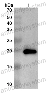 Anti-Human TRAPPC6A Polyclonal Antibody