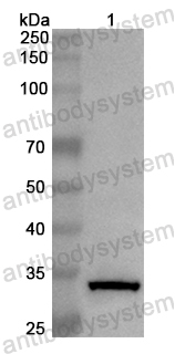 Anti-Human TUSC2 Polyclonal Antibody