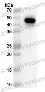 Anti-Human GABBR2 Polyclonal Antibody