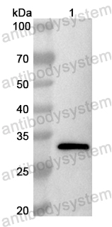 Anti-Human PIAS2 Polyclonal Antibody