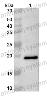 Anti-Human SASH3 Polyclonal Antibody