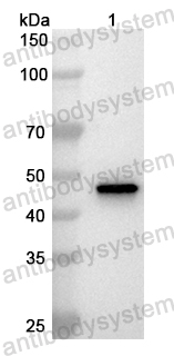 Anti-Human SEC14L2 Polyclonal Antibody