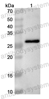 Anti-Human RECQL5 Polyclonal Antibody