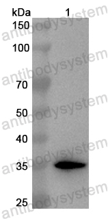 Anti-Human STK10 Polyclonal Antibody