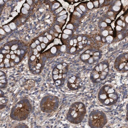 Immunohistochemical for Anti-Human DDHD2 Polyclonal Antibody ?>