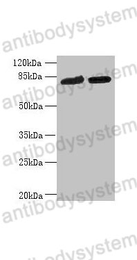 Western Blot for Anti-Human DDHD2 Polyclonal Antibody ?>