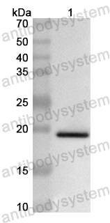 Anti-Human SASH1 Polyclonal Antibody