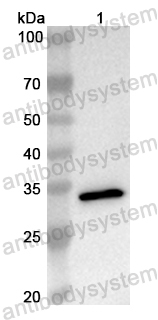 Anti-Human LRIG2 Polyclonal Antibody