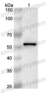 Anti-Human GLCE Polyclonal Antibody
