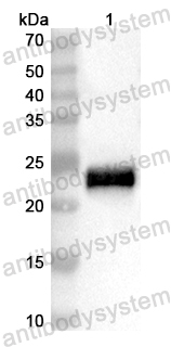 Anti-Human UBOX5 Polyclonal Antibody