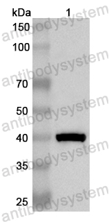 Anti-Human KDM4B Polyclonal Antibody