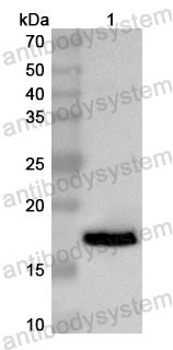Anti-Human TRIM37 Polyclonal Antibody