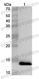 Anti-Human SOX30 Polyclonal Antibody