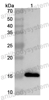 Anti-Human KCNK2 Polyclonal Antibody