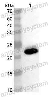 Anti-Human ZNF202 Polyclonal Antibody
