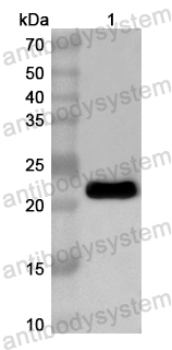 Anti-Human DUSP14 Polyclonal Antibody