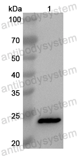Anti-Human SNUPN Polyclonal Antibody