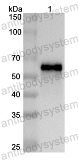 Anti-Human FKBP9 Polyclonal Antibody