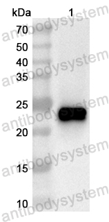 Anti-Human SMC2 Polyclonal Antibody