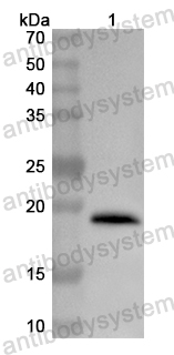 Anti-Human SLU7 Polyclonal Antibody
