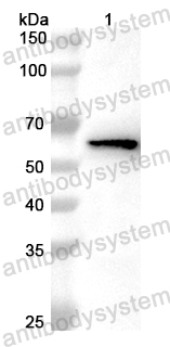 Anti-Human PGM3 Polyclonal Antibody