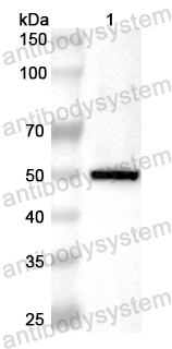 Anti-Human GCNT3 Polyclonal Antibody