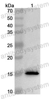 Anti-Human MED26 Polyclonal Antibody