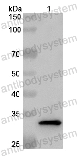 Anti-Human TNFRSF6B Polyclonal Antibody