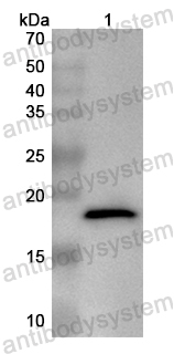 Anti-Human AHSA1 Polyclonal Antibody