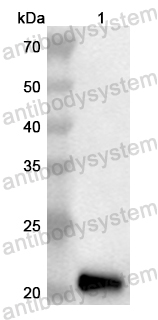 Anti-Human APOM Polyclonal Antibody