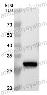 Anti-Human ETHE1 Polyclonal Antibody