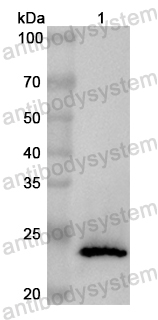 Anti-Human POLR1A Polyclonal Antibody