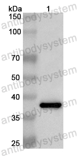 Anti-Human LSM8 Polyclonal Antibody