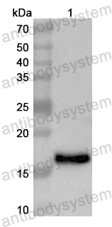 Anti-Human TSPAN12 Polyclonal Antibody