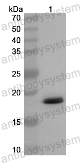 Anti-Human TXNDC12 Polyclonal Antibody