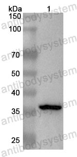 Anti-Human CBX7 Polyclonal Antibody