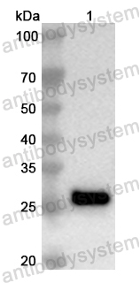 Anti-Human TGM6 Polyclonal Antibody