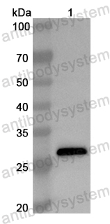 Anti-Human TBX18 Polyclonal Antibody